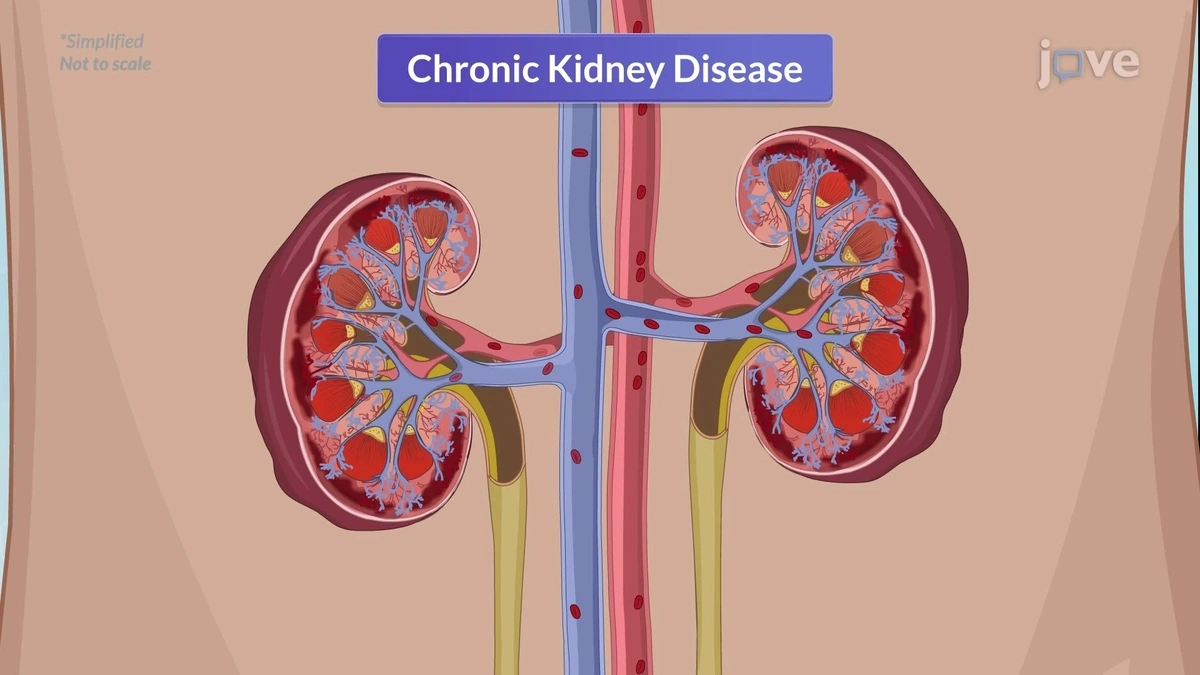 Kidney Disease